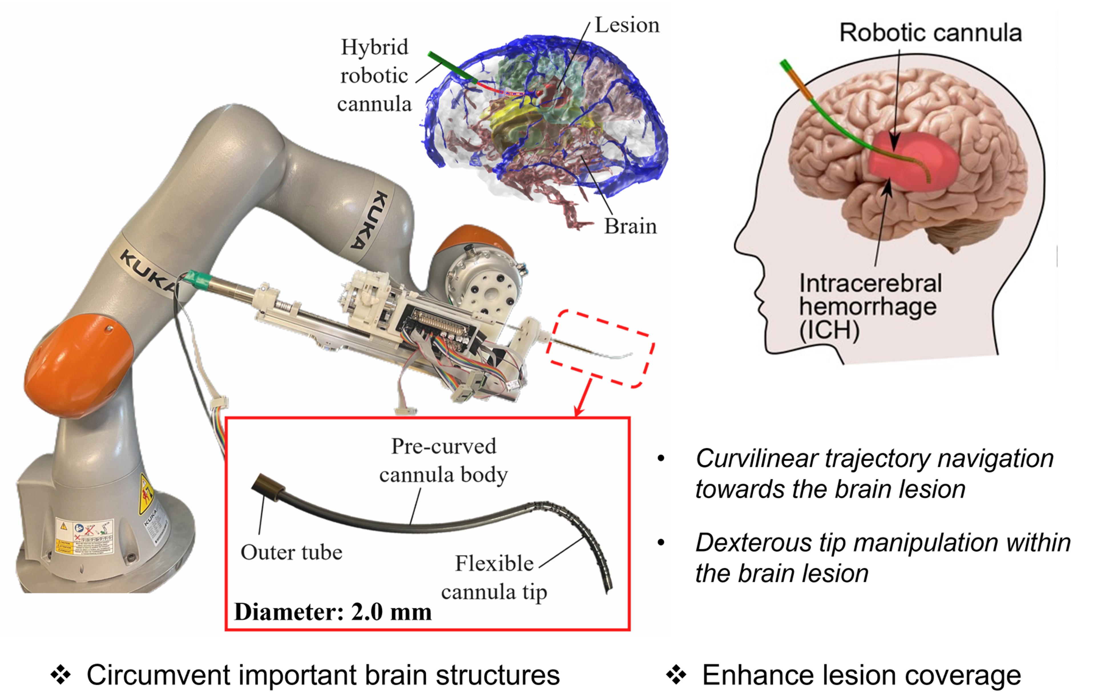 An Intelligent Flexible Robotic System for Minimally Invasive Neurosurgery